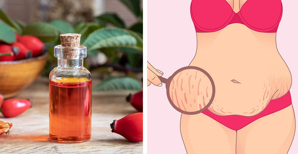 Benefits of Rosehip Seed Oil