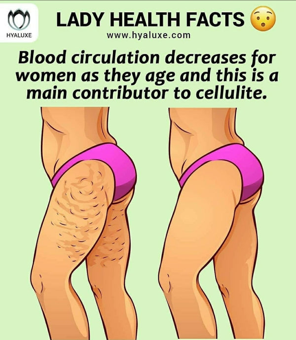 Cellulite - Why we have it and how can we get rid of it? Let's get to it --->